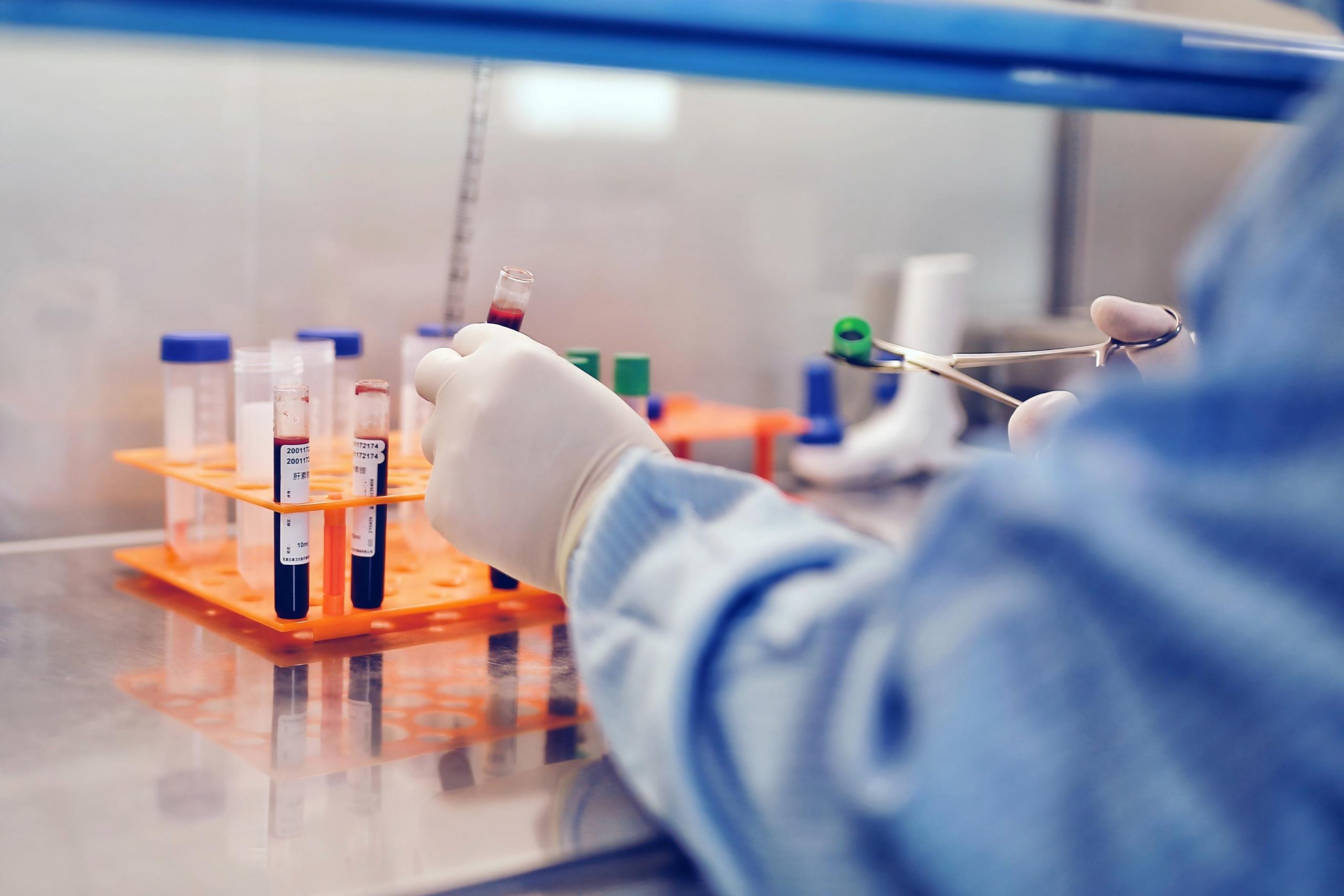 Pigeon Paramyxovirus Type 1 (PPMV-1) RNA Test Kit – RT-qPCR - SENO Bird ...